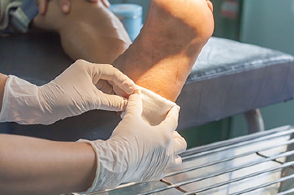 Wound Care for a Cut on the Foot