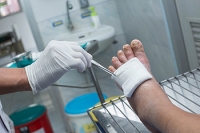 What Are Foot Ulcers and Who Is Most at Risk?