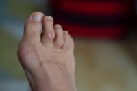 When Toes Begin to Curl