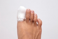 The Prevalence of Broken Toes